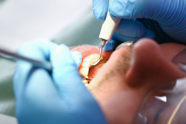 Best Emergency Dental Care for Sports Injuries in East Williston, NY