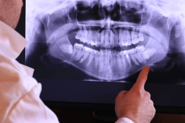 Best Emergency Root Canal Therapy in East Williston, NY