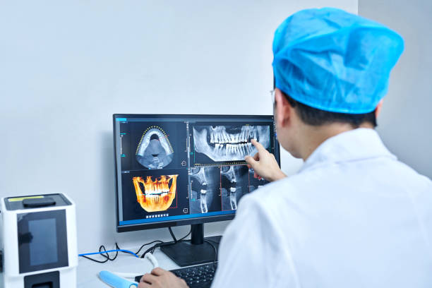 Best Knocked-Out Tooth (Avulsed Tooth) Treatment in East Williston, NY